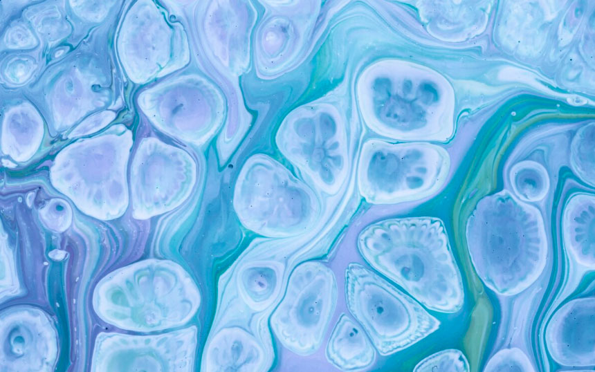 Células anormais (citologia urinária)