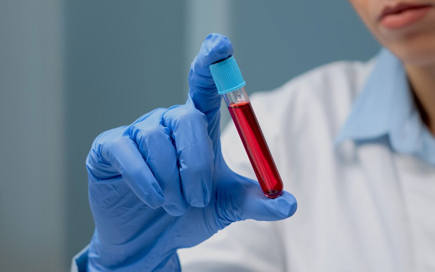 Minimização da invasividade