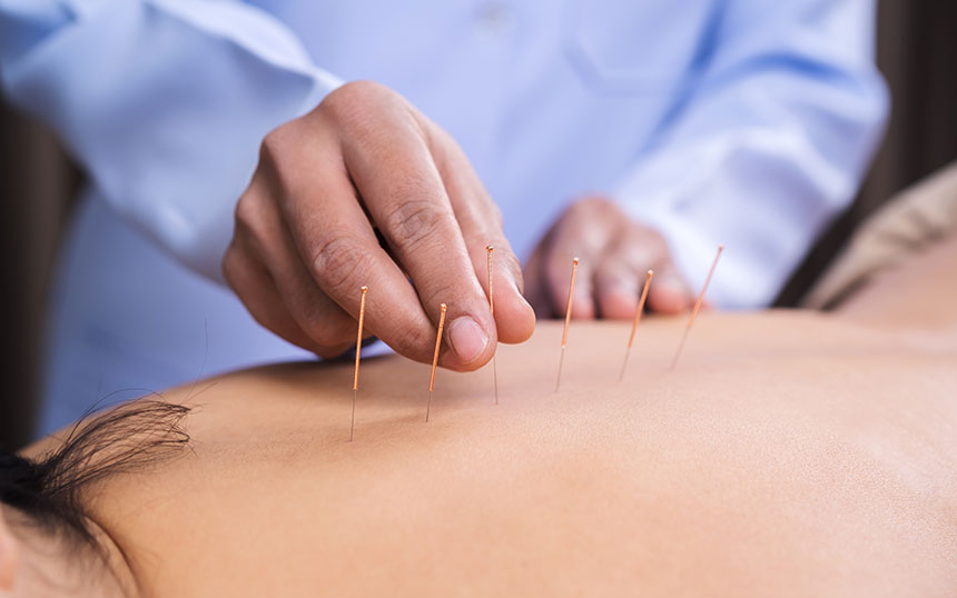 Acupuntura - Terapias integrativas