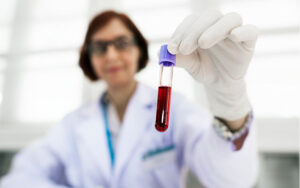 Câncer de rim: sintomas, fatores de risco e quando procurar um especialista